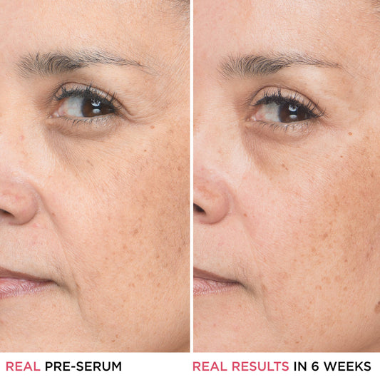 IT Cosmetics Bye Bye Lines Hyaluronic Acid Serum 30ml bottle, clear glass container with dropper for beauty skincare.