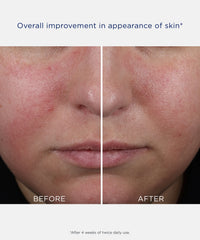 Neostrata Clarify Mandelic Clarifying Hydragel in 50ml bottle showing before and after skin results.