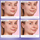 Glow Recipe  Blackberry Retinol Blemish Serum NIB - LAB
