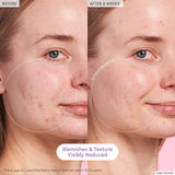 Glow Recipe  Blackberry Retinol Blemish Serum NIB - LAB