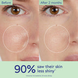 Caudalie  Vinopure Salicylic Acid Pore Minimizing Toner Jumbo 400ml NWOB - LAB