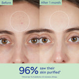 Caudalie  Vinopure Pore Purifying Gel Cleanser 150ml NWOB - LAB