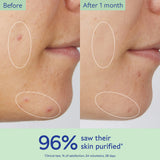 Caudalie  Vinopure Pore Purifying Gel Cleanser 150ml NWOB - LAB