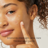 COSRX Acne Pimple Master Patches - LAB